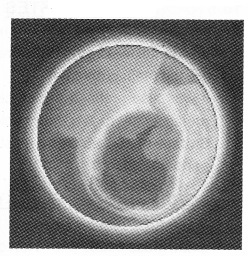 Plus Two Botany Notes Chapter 8 Environmental Issues 6